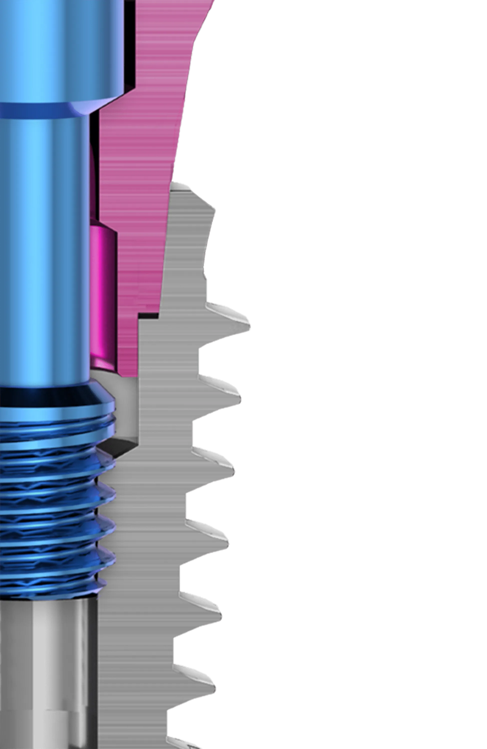 Tight, Strong & Stable Seal 5° Conical Connection.<br/> Inserta P-3’s five degrees Conical connection design provides a tight, strong and stable fit between implant and abument, <span class="text-primary-500">reduces peak stresses and thereby preserves the marginal bone.</span> The interior of the implant is sealed off from surrounding tissue, minimising micromovements and microleakage.