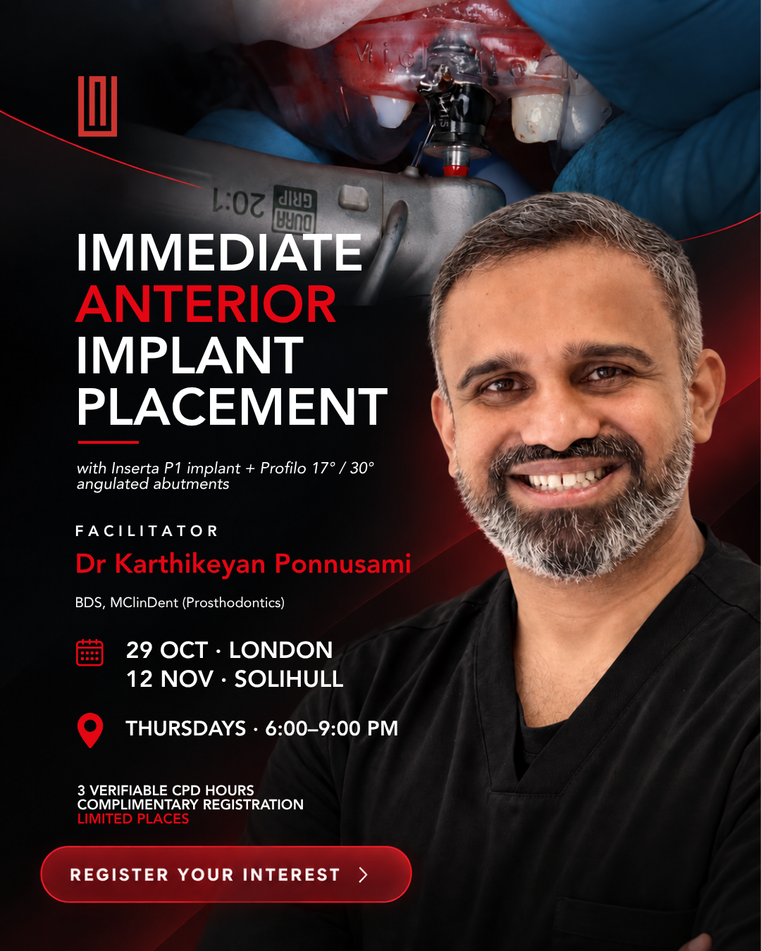 Immediate Antetior Implant Placement