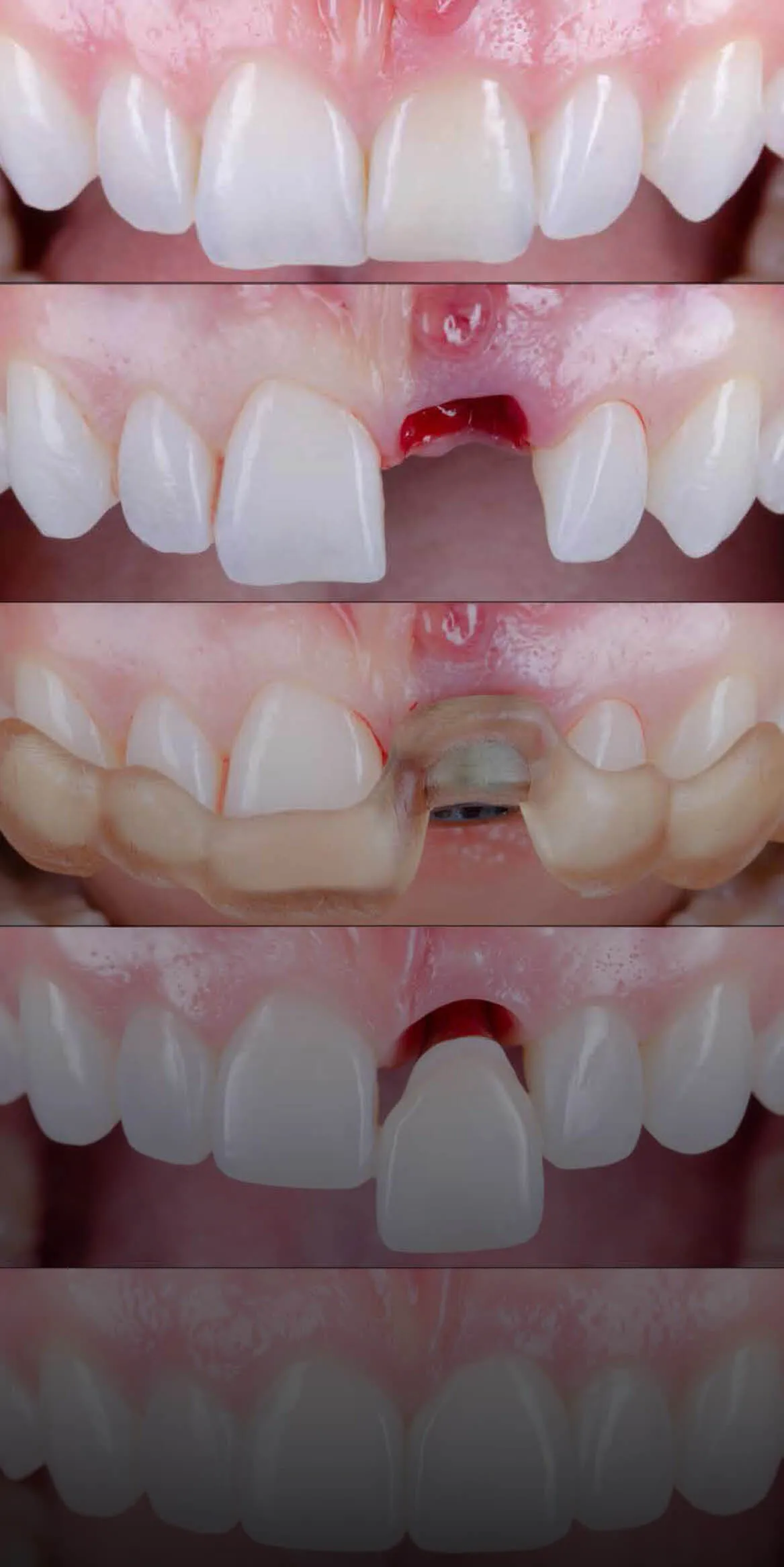 Implant Xperience 2025