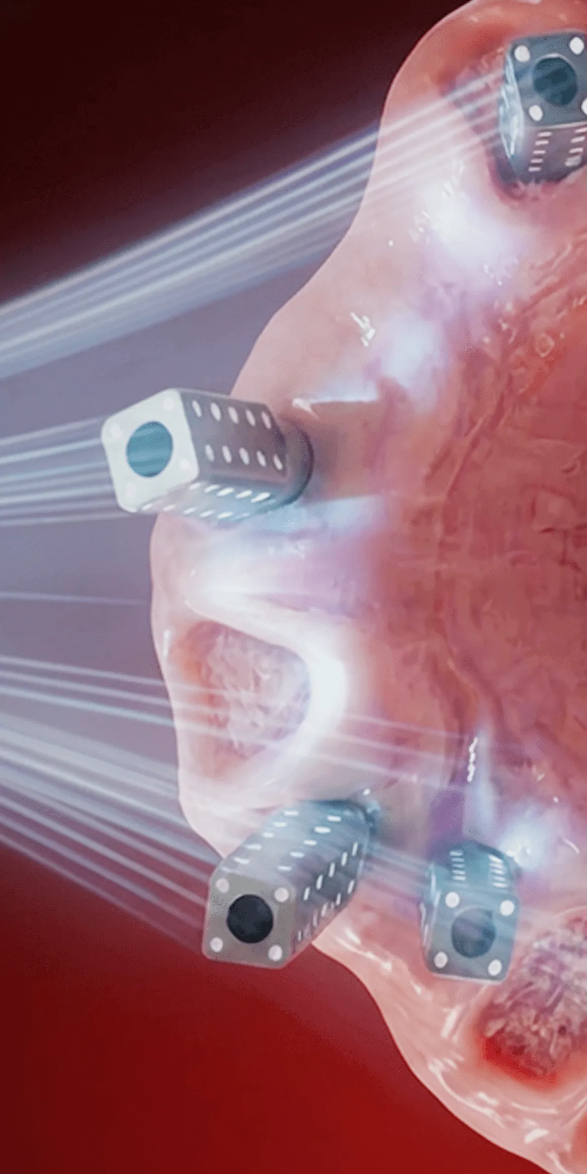 Digital Full Arch Protocol & the Photogrammetry’s Role in Full Arch Success