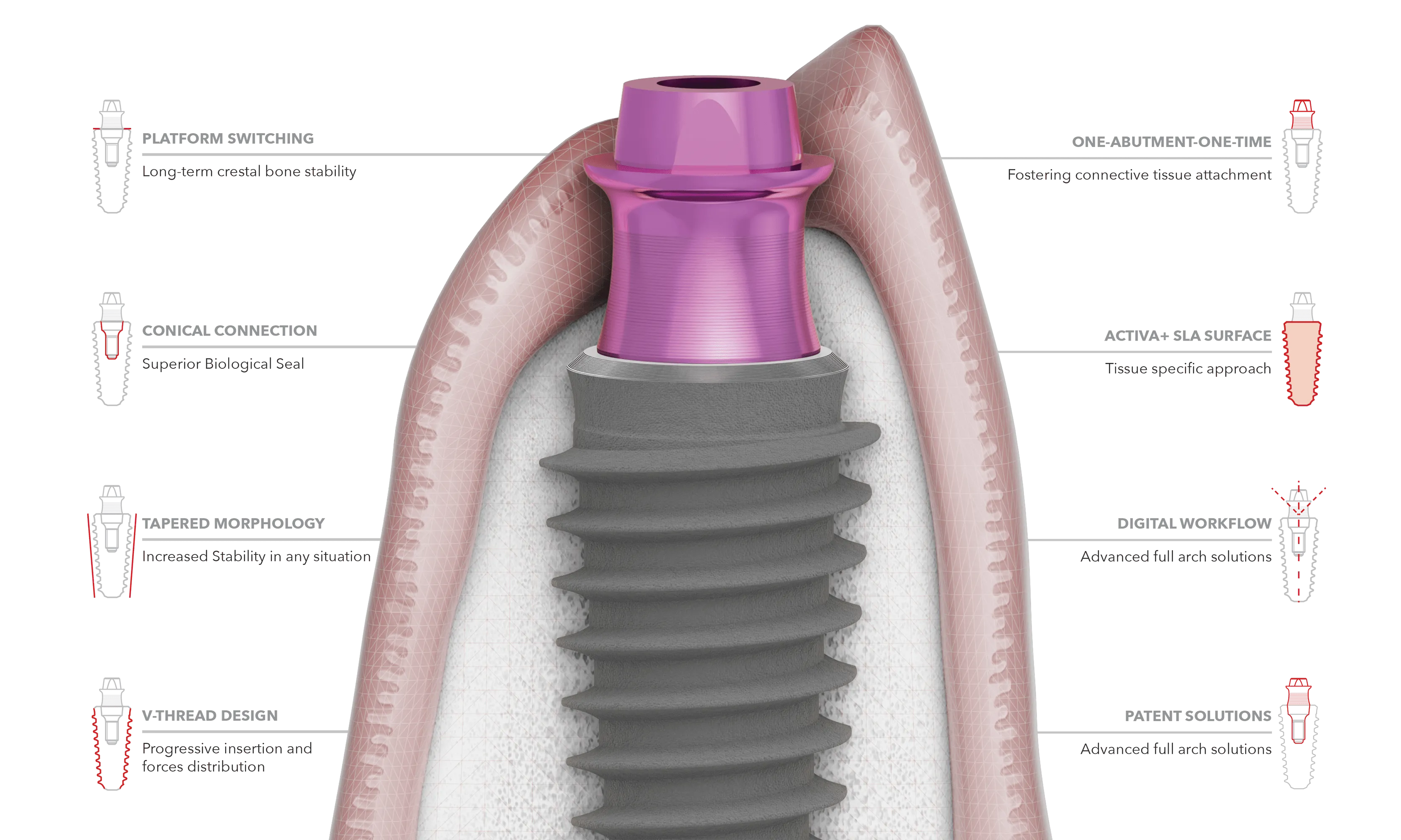 P-3 Implant