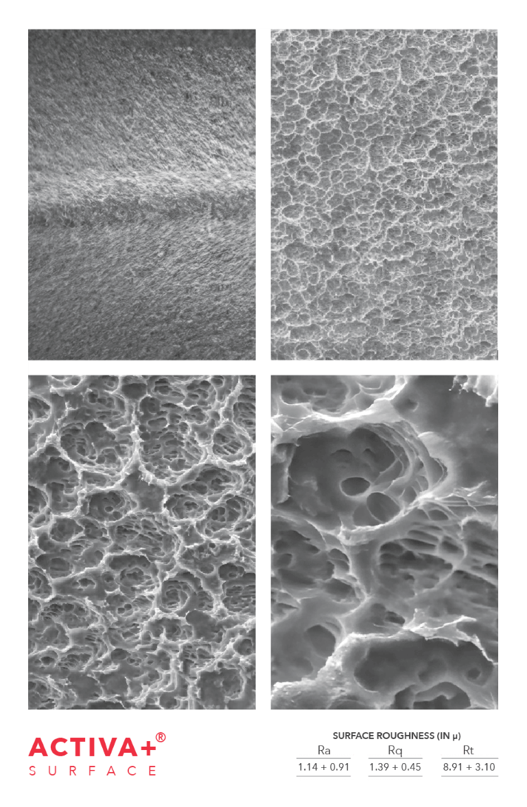 Surface