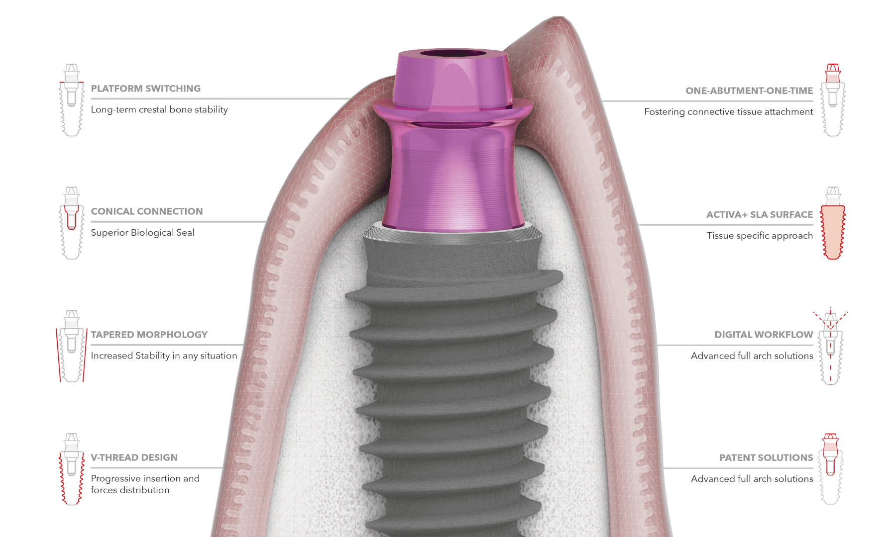 P-3 Implant