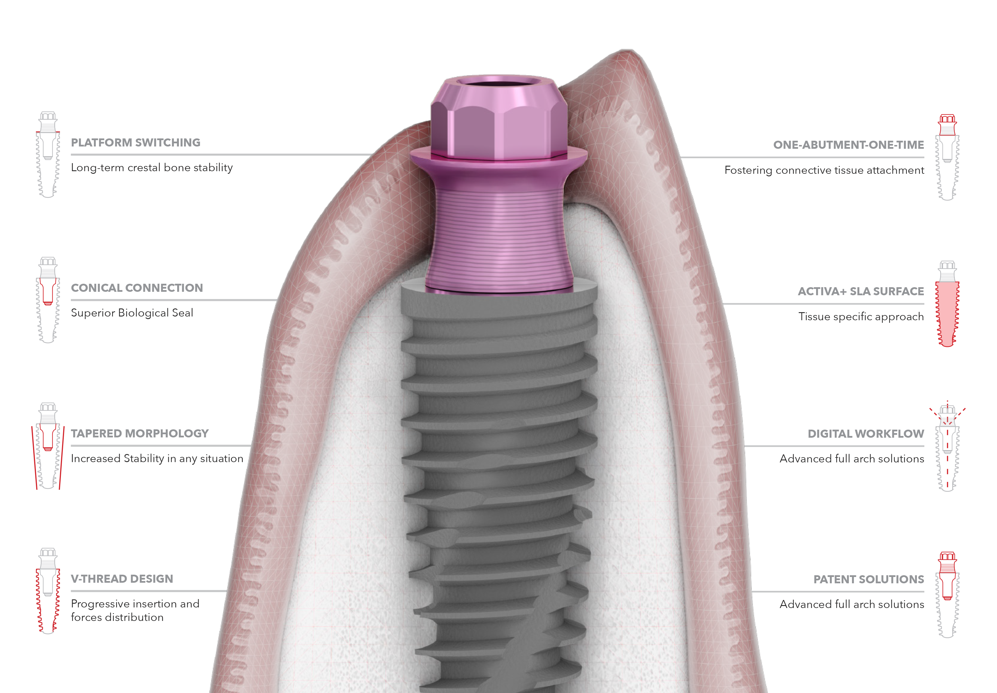 P-3 Implant